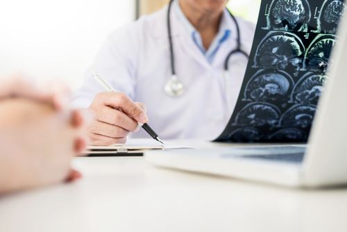 Doctor looking at a brain injury scan